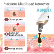 Blackhead Remover, Pore Vacuum Cleaner Black Dot, Nose Pore Acne Facial Cleaning, Pimple Remover Beauty Tool