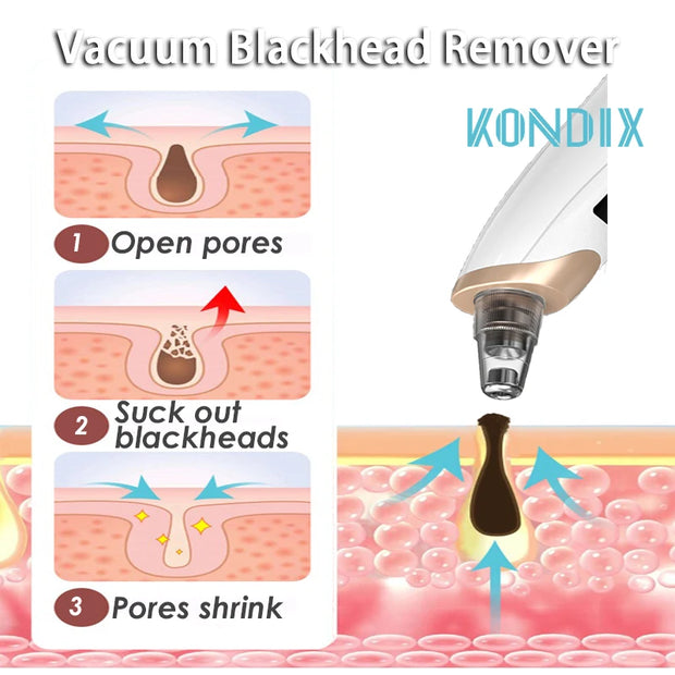 Blackhead Remover, Pore Vacuum Cleaner Black Dot, Nose Pore Acne Facial Cleaning, Pimple Remover Beauty Tool